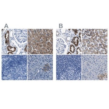 Anti-AMACR antibody produced in rabbit affinity isolated antibody, buffered aqueous glycerol solution