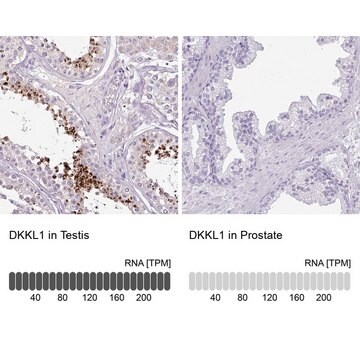 Anti-DKKL1 antibody produced in rabbit Prestige Antibodies&#174; Powered by Atlas Antibodies, affinity isolated antibody, buffered aqueous glycerol solution