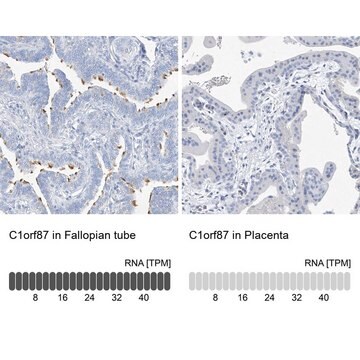 Anti-C1orf87 antibody produced in rabbit Prestige Antibodies&#174; Powered by Atlas Antibodies, affinity isolated antibody, buffered aqueous glycerol solution