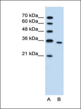 Anti-PRPS2 antibody produced in rabbit IgG fraction of antiserum