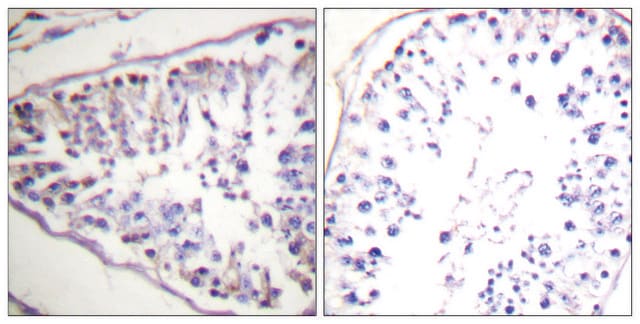 Anti-HSL antibody produced in rabbit affinity isolated antibody