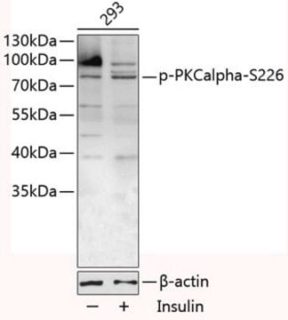 Anti-Phospho-PKCalpha-S226 antibody produced in rabbit