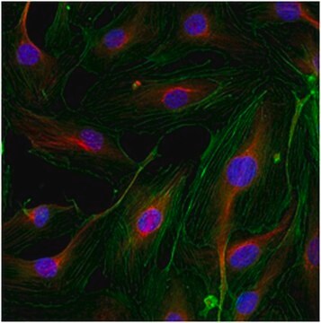 Anti-PHLPP2 Antibody from rabbit, purified by affinity chromatography