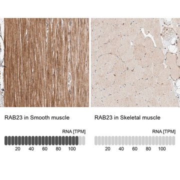 Anti-RAB23 antibody produced in rabbit Prestige Antibodies&#174; Powered by Atlas Antibodies, affinity isolated antibody, buffered aqueous glycerol solution, ab2