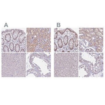 Anti-RBL1 antibody produced in rabbit Prestige Antibodies&#174; Powered by Atlas Antibodies, affinity isolated antibody, buffered aqueous glycerol solution