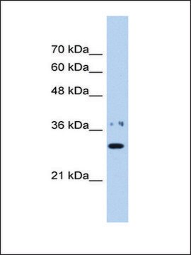 Anti-NMNAT1 IgG fraction of antiserum