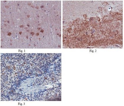 抗-C-X-C 趋化因子受体5型（CXCR5）抗体。 from rabbit, purified by affinity chromatography