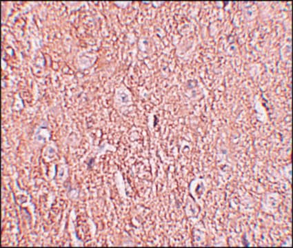 Anti-LRRTM2 antibody produced in rabbit affinity isolated antibody