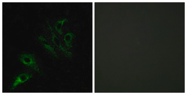 Anti-TNFL4 antibody produced in rabbit affinity isolated antibody