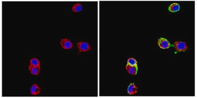 Anticorps anti-molécule d’adhésion des cellules neurales L1, clone&nbsp;324 clone 324, Chemicon&#174;, from rat