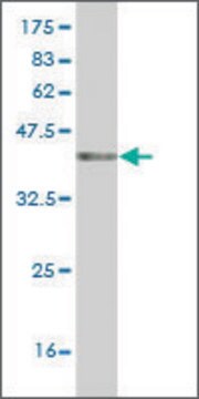 Monoclonal Anti-K6HF antibody produced in mouse clone 2E3, ascites fluid