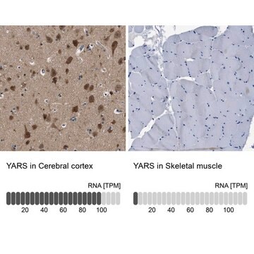 Anti-YARS antibody produced in rabbit Prestige Antibodies&#174; Powered by Atlas Antibodies, affinity isolated antibody, buffered aqueous glycerol solution