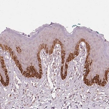 Anti-TUB antibody produced in rabbit Prestige Antibodies&#174; Powered by Atlas Antibodies, affinity isolated antibody, buffered aqueous glycerol solution