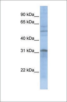 Anti-MTCH2 (ab2) antibody produced in rabbit affinity isolated antibody