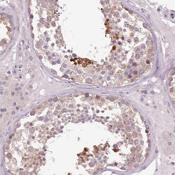 Anti-SETX antibody produced in rabbit Prestige Antibodies&#174; Powered by Atlas Antibodies, affinity isolated antibody, buffered aqueous glycerol solution