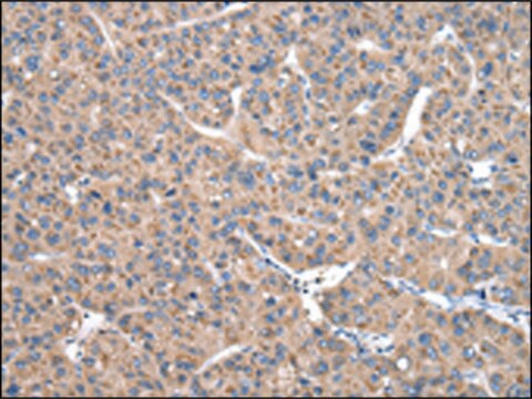 Anti-CASK affinity isolated antibody