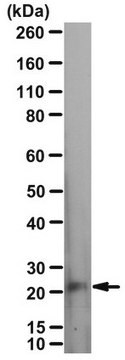 Anti-p75NTR Antibody, ICD serum, from rabbit