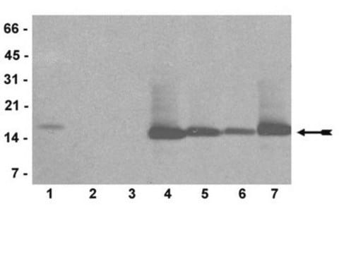 Anticuerpo anti-mono/di/ trimetil-histona H3 (Lys4), clon AW304, monoclonal de conejo culture supernatant, clone AW304, Upstate&#174;