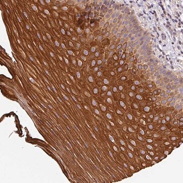 Anti-CCDC28A antibody produced in rabbit Prestige Antibodies&#174; Powered by Atlas Antibodies, affinity isolated antibody, buffered aqueous glycerol solution