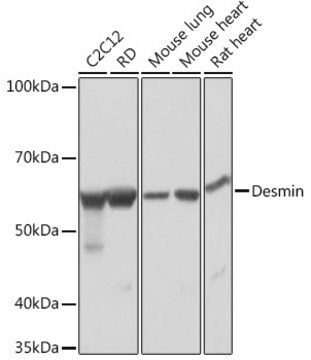 Anti-Desmin Antibody, clone 6O9O4, Rabbit Monoclonal