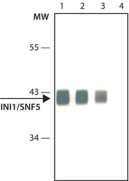 Anti- INI1/SNF5 antibody, Mouse monoclonal clone 2C2, purified from hybridoma cell culture