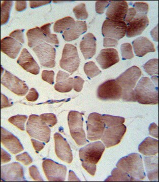 ANTI-PATL1 (C-TERM) antibody produced in rabbit IgG fraction of antiserum, buffered aqueous solution