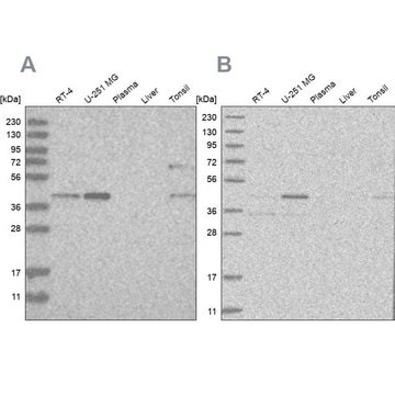 Anti-RTCA antibody produced in rabbit Prestige Antibodies&#174; Powered by Atlas Antibodies, affinity isolated antibody, buffered aqueous glycerol solution