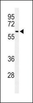 ANTI-SNX27 (CENTER) antibody produced in rabbit affinity isolated antibody, buffered aqueous solution