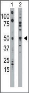 Anti-EKI1 (N-term) antibody produced in rabbit IgG fraction of antiserum, buffered aqueous solution