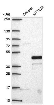 Anti-KRT222 antibody produced in rabbit Prestige Antibodies&#174; Powered by Atlas Antibodies, affinity isolated antibody, buffered aqueous glycerol solution