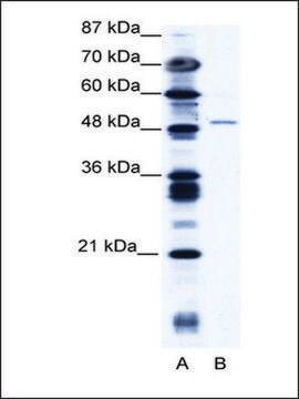 Anti-ZNF627 antibody produced in rabbit affinity isolated antibody