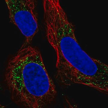 Anti-PMEPA1 antibody produced in rabbit Prestige Antibodies&#174; Powered by Atlas Antibodies, affinity isolated antibody