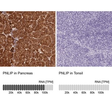 Anti-PNLIP antibody produced in rabbit Prestige Antibodies&#174; Powered by Atlas Antibodies, affinity isolated antibody, buffered aqueous glycerol solution