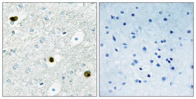 Anti-TPD52 antibody produced in rabbit affinity isolated antibody