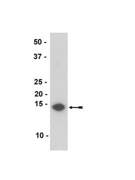 Anti-&#945;-Synuclein-Antikörper, Klon Syn211 ascites fluid, clone Syn211, Upstate&#174;