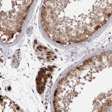 Anti-RTCA antibody produced in rabbit Prestige Antibodies&#174; Powered by Atlas Antibodies, affinity isolated antibody, buffered aqueous glycerol solution, ab2