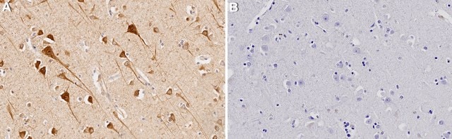 Anti-CYP46A1 Antibody, clone 1C20 ZooMAb&#174; Rabbit Monoclonal recombinant, expressed in HEK 293 cells