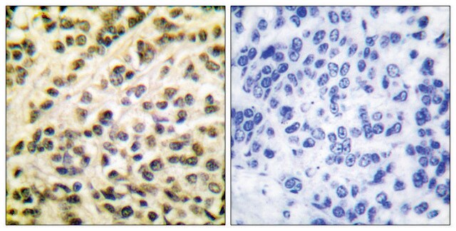 Anti-FLI1 antibody produced in rabbit affinity isolated antibody