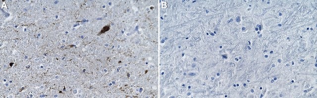 Anti-&#945;-Synuclein Antibody, clone Syn211 ZooMAb&#174; Mouse Monoclonal recombinant, expressed in HEK 293 cells