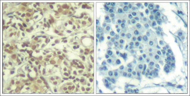 Anti-phospho-AKT1 (pThr450) antibody produced in rabbit affinity isolated antibody