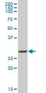 Anti-COMT antibody produced in mouse purified immunoglobulin, buffered aqueous solution