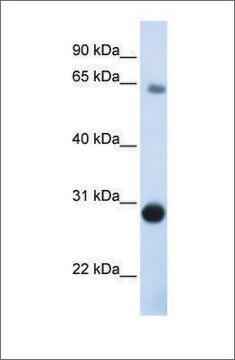 Anti-DERL3 antibody produced in rabbit affinity isolated antibody