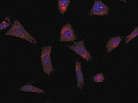 Anti-ALS2 (N-terminal region) antibody produced in rabbit ~1.5&#160;mg/mL, affinity isolated antibody