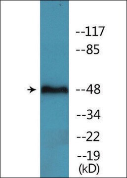 Anti-phospho-GFAP (pSer38) antibody produced in rabbit affinity isolated antibody