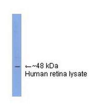 Anti-Arrestin Antibody, visual ascites fluid, Chemicon&#174;