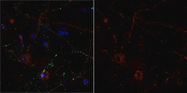 Anti-Metabotropic Glutamate Receptor 5 Antibody, Alexa Fluor&#8482; 555 from rabbit, ALEXA FLUOR&#8482; 555