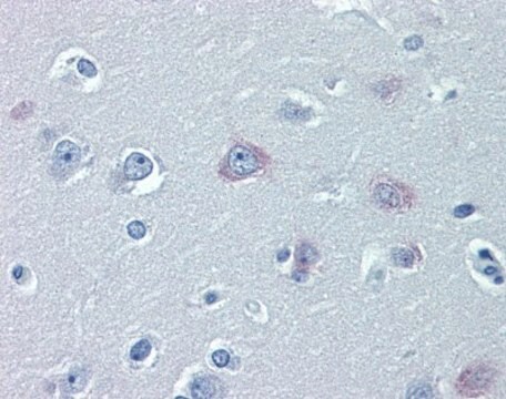 Anti-TRPM2 antibody produced in rabbit affinity isolated antibody