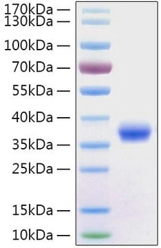 Rekombinantes 2019-nCoV-Spike-RBD-Protein mit His-Tag