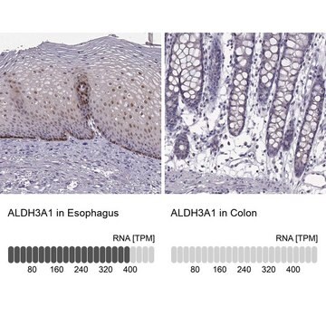 Anty-ALDH3A1 Prestige Antibodies&#174; Powered by Atlas Antibodies, affinity isolated antibody