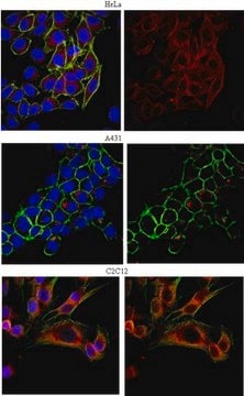 Anti-EEA1 Antibody from rabbit, purified by affinity chromatography